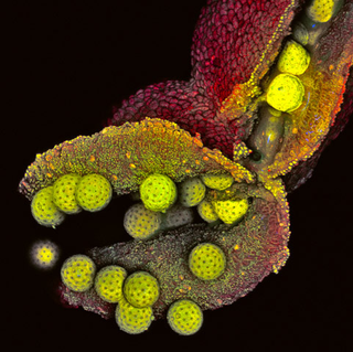 Illustration for article titled Remarkable Nikon Small World Microscope Photography Winners